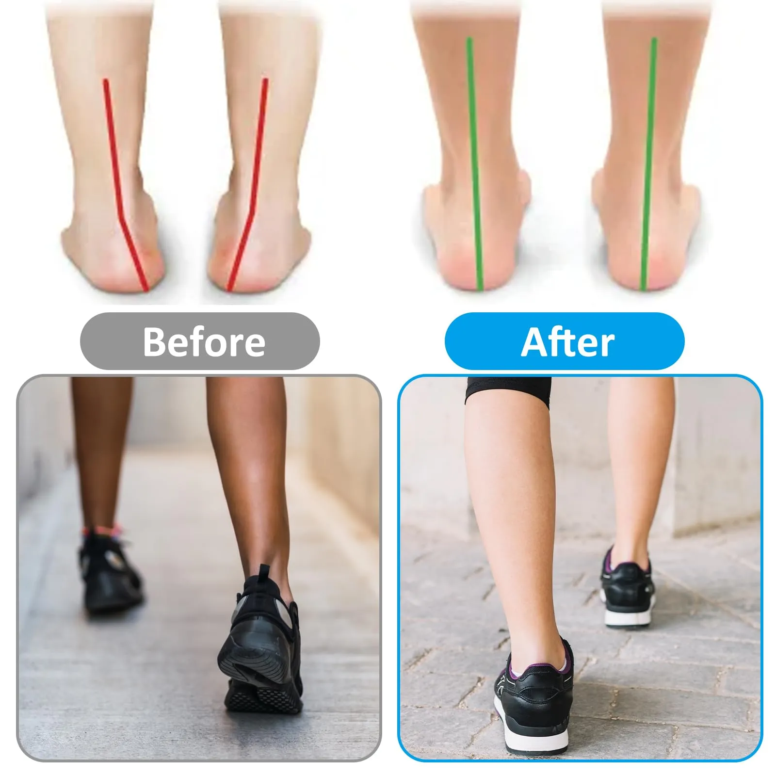 Arch Support, 2 Piece Metatarsal Support Adjustable Plantar Fasciitis Bandage Metatarsal Support for Men and Women to Relieve Plantar Fasciitis and Arch Pain