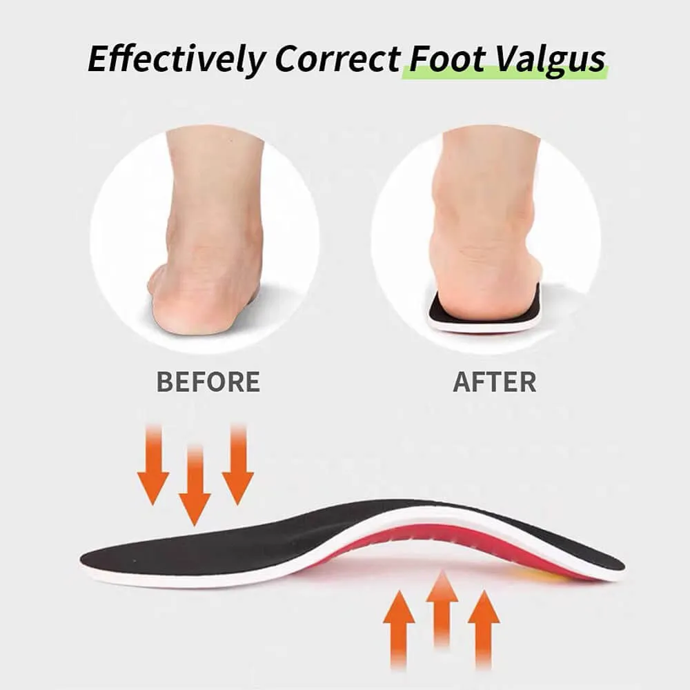 Arch Support Foot Insoles For Running